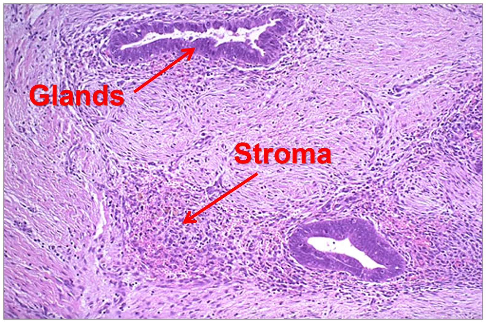 The John B. Pierce Laboratory » New Research Seeks To Improve Heart ...